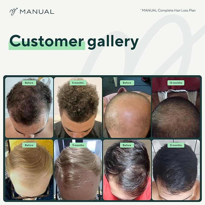 Manual Biotin & Collagen Hair Growth Vitamins (30 Capsules) – Supports Thicker, Healthier Hair – with Essential Nutrients for Hair Loss & Thinning – Take 1 Daily – 1 Month Supply